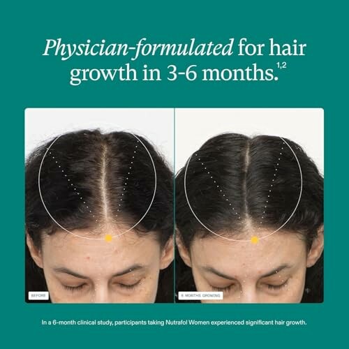 Comparison of hair growth before and after 6 months.